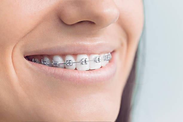 Best Traditional Braces  in Waymart, PA